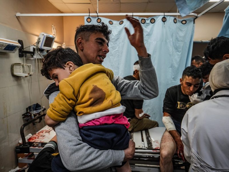 Injured Palestinians, including children, are brought to Nasser Hospital to receive medical treatment following Israeli attacks in Khan Yunis, Gaza on January 22, 2024. Photo by Belal Khaled/Anadolu via Getty Images