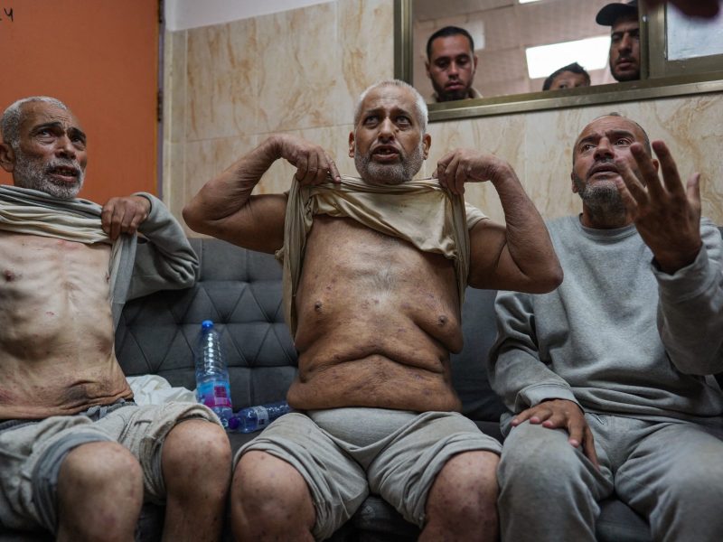 Palestinian men who had been detained by Israeli forces speak to well-wishers and reporters after their release as they arrive for a check-up at the Al-Aqsa Martyrs Hospital in Deir el-Balah in the central Gaza Strip on July 1, 2024 amid the ongoing conflict between Israel and the Palestinian Hamas movement. Photo by BASHAR TALEB/AFP via Getty Images