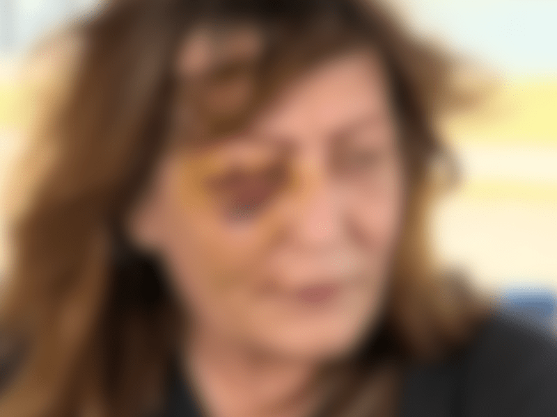 A blurred photograph of activist and influencer Carolina Ft. Worth with severe bruises on her face after a violent encounter with Fort Worth police. Photos courtesy of Caroline Ft. Worth