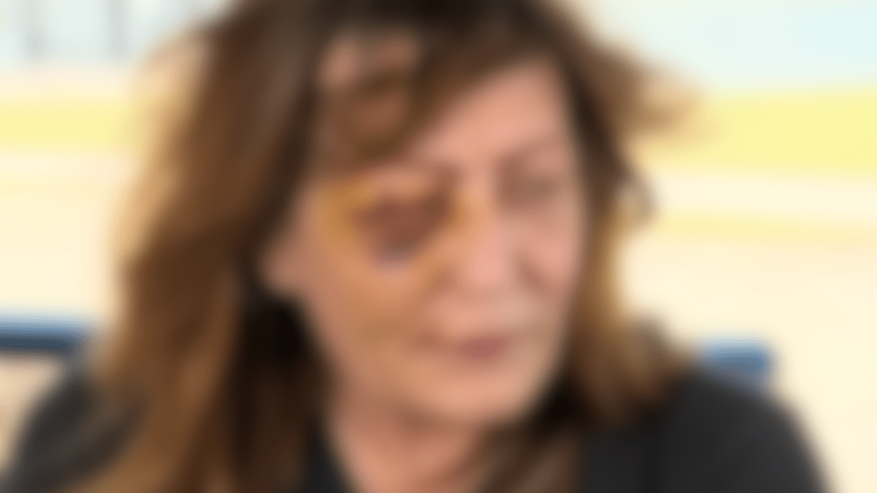 A blurred photograph of activist and influencer Carolina Ft. Worth with severe bruises on her face after a violent encounter with Fort Worth police. Photos courtesy of Caroline Ft. Worth